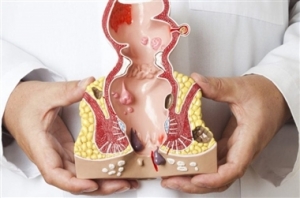 اشکال دارویی رکتال (مقعدی)