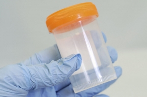 ویژگی های فیزیکی در آزمایش ادرار