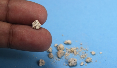 داروهای ضد سنگ کلیه