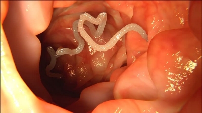 اشکال دارویی ریوی و بینی و ...