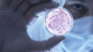 شناخت عوامل موثرعفونت در آزمایشگاه