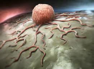 چرا در گذشته اینقدر سرطان رایج نبود⁉️